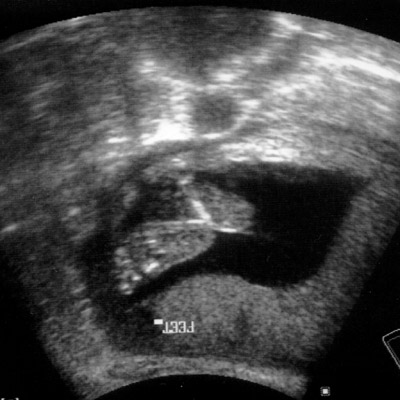 Baby Boy's Feet