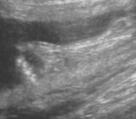 Baby Boy's Fist
