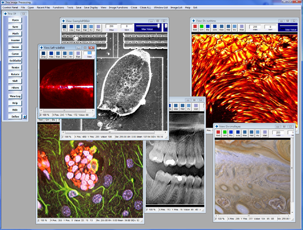 Tria                                      Image Processing Screen Shot