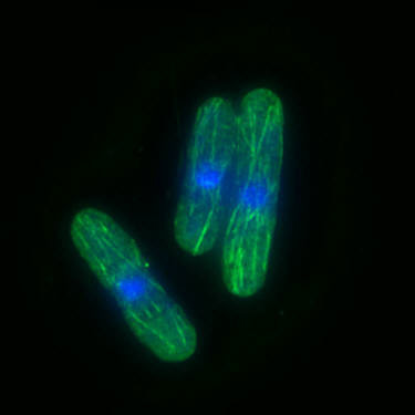 This image of fission yeast was supposedly deburred on another website.