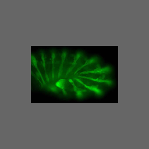 A microscope image of fission yeast that already undergone some processing.  This image was displayed on several websites as an example of good deconvolution. 