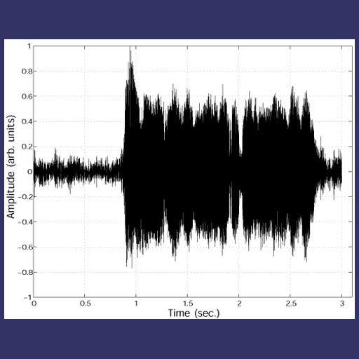 The signal was processed using our one-dimensional SeDDaRA program.  Although there is some amplification of noise in the higher frequencies, the signal has improved tremendously.  It sounded better too.    